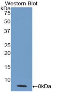 CDw218a / IL18R1 Antibody (aa375-428)