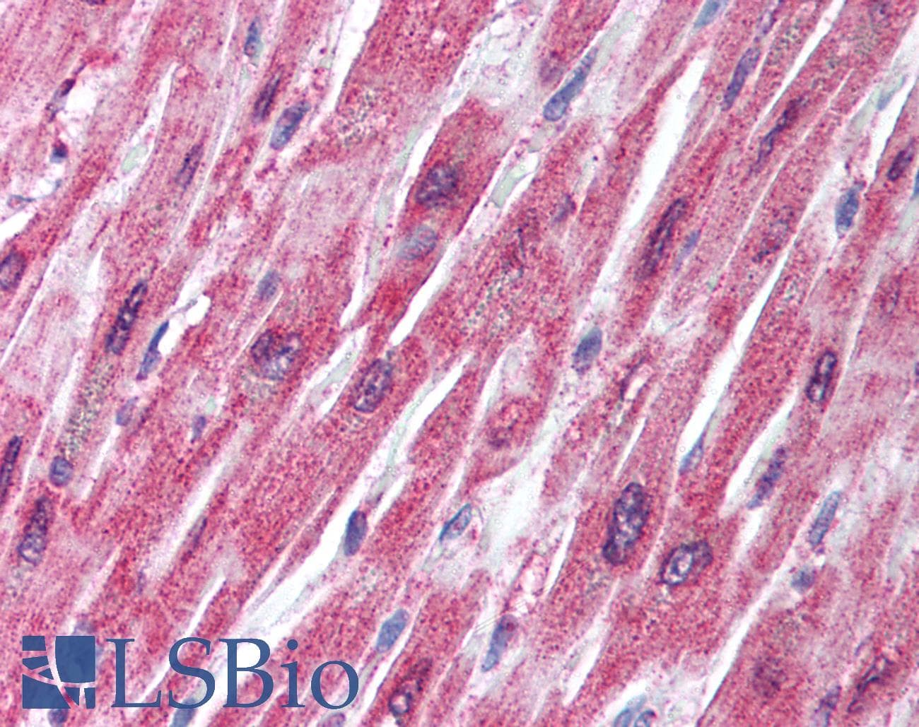 PathPlus™ Polyclonal Rabbit anti-Human TRAF2 Antibody (IHC, IF, WB)