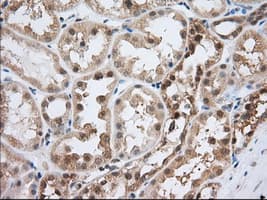 ACAT2 Antibody (clone OTI5A2)
