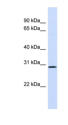 Polyclonal Rabbit anti-Human FGF14 Antibody (aa151-200, WB)