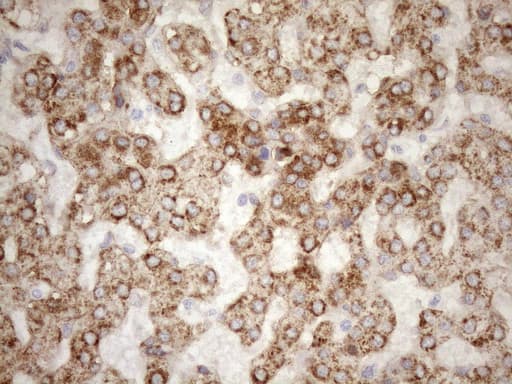 Monoclonal Mouse anti-Human NT5E / eNT / CD73 Antibody (clone OTI1G2, aa119-232, IHC, WB)