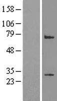 LRP2BP / LRP2 Binding Protein (Over-Expression Lysate Myc-DDK (Flag))