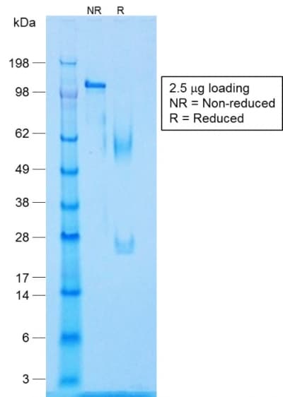 CALD1 / Caldesmon Antibody (clone CALD1/1424R, Azide-free, Carrier-free)