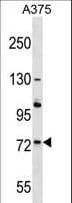 ACOX2 Antibody (aa1-30)