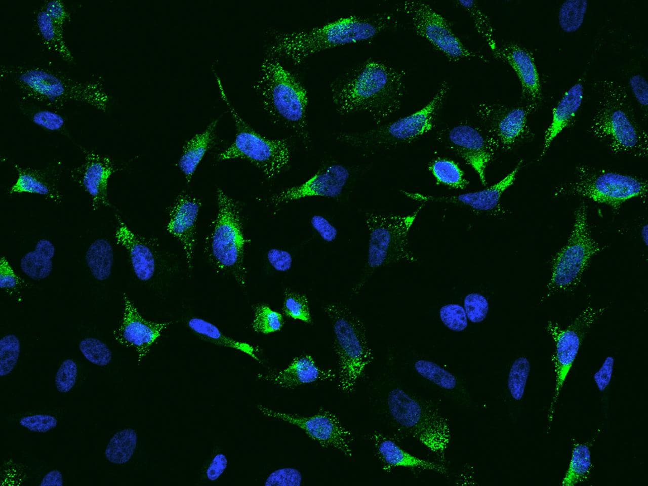 POSTN / Periostin Antibody