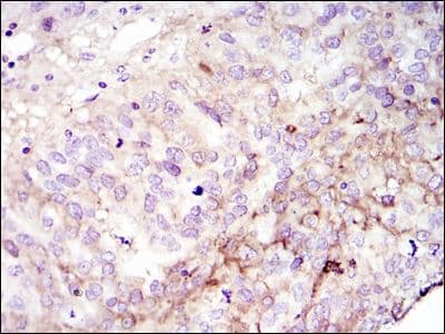 Monoclonal Mouse anti-Human FAK / Focal Adhesion Kinase Antibody (clone 10H7, IHC, IF, WB)