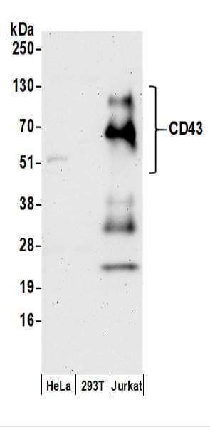 SPN / CD43 Antibody (aa350-400)