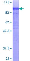 Human COL14A1 / Collagen XIV Protein (Recombinant GST)
