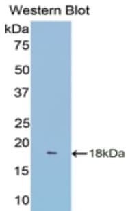 CD95 / FAS Antibody (aa188-319, PE)