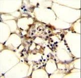C11orf95 Antibody (aa556-584)