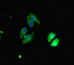 Polyclonal Rabbit anti-Human CHD4 Antibody (IHC, IF)