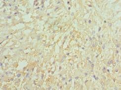 LMOD1 Antibody (aa29-187)