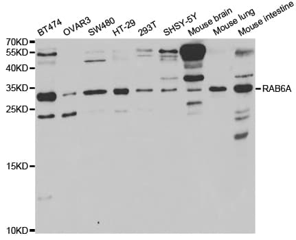 Polyclonal Rabbit anti-Human RAB6A / RAB6 Antibody (IHC, IF, WB)