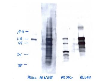 PR / Progesterone Receptor Antibody (phospho-Ser162, clone 1064/E2)
