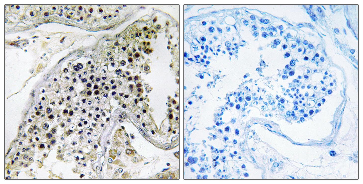 Polyclonal Rabbit anti-Human PABPC3 Antibody (IHC)