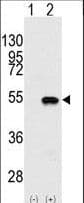SMYD2 Antibody (aa120-152)