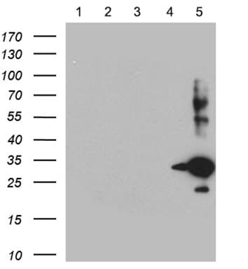 SSTR5 Antibody (clone OTI1E4)