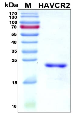 Human HAVCR2 / TIM-3 Protein (Recombinant His, N-Terminal)