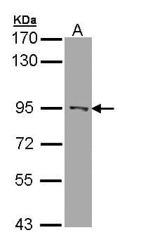 Polyclonal Rabbit anti-Human RASAL1 / RASAL Antibody (aa516-787, WB)