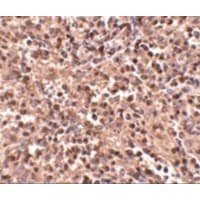 APG5 / ATG5 Antibody