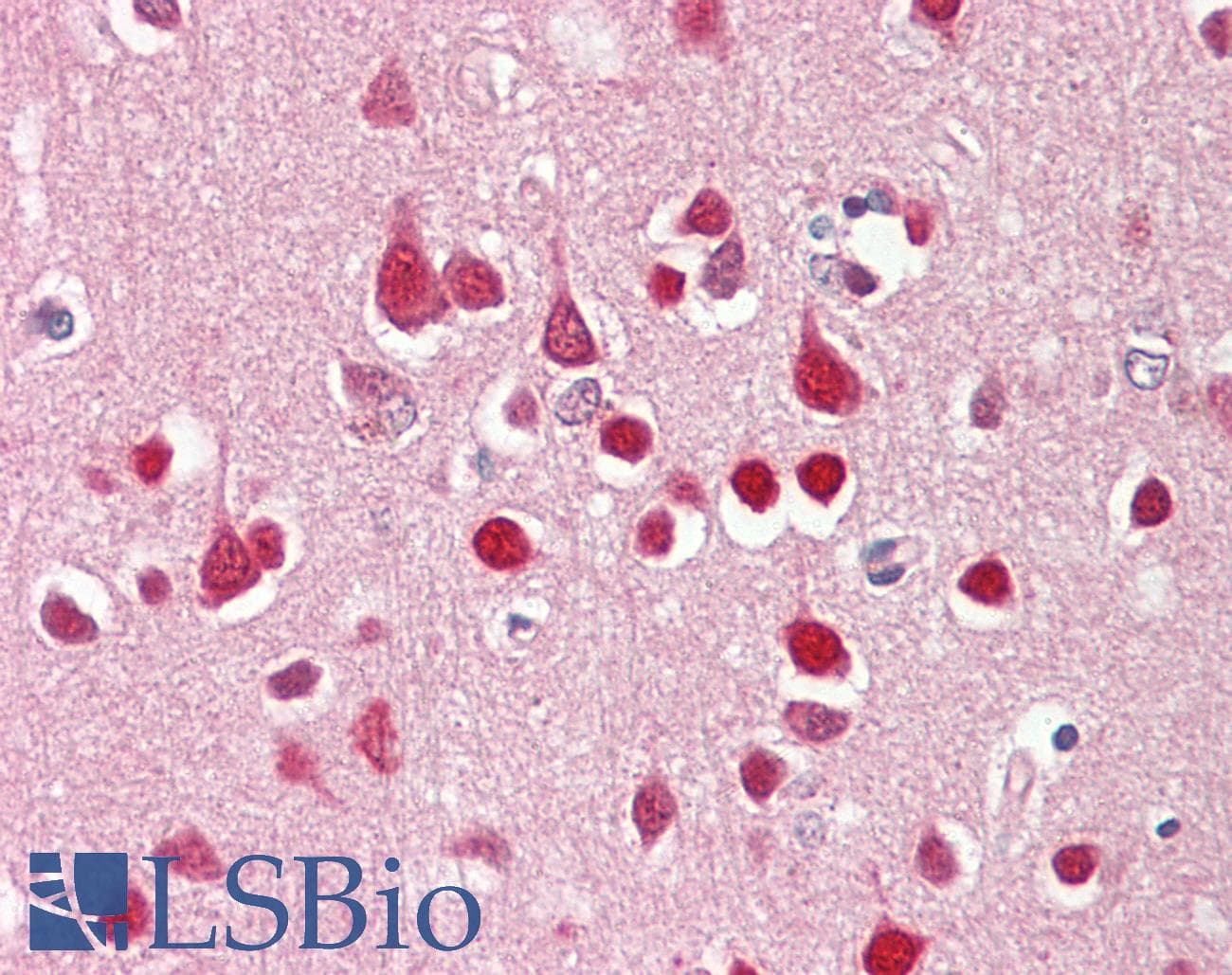 IHC-plus™ NR3C1/Glucocorticoid Receptor Antibody (clone 6E6)