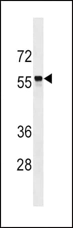 SLC22A2 Antibody (aa514-541)