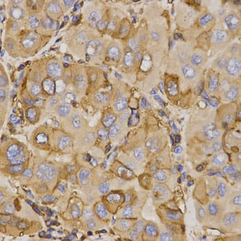 ABCC5 / MRP5 Antibody