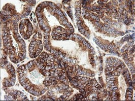 ROMO1 Antibody (clone OTI1G4)