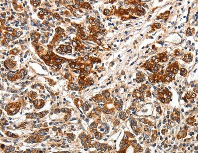 BRUCE / BIRC6 Antibody