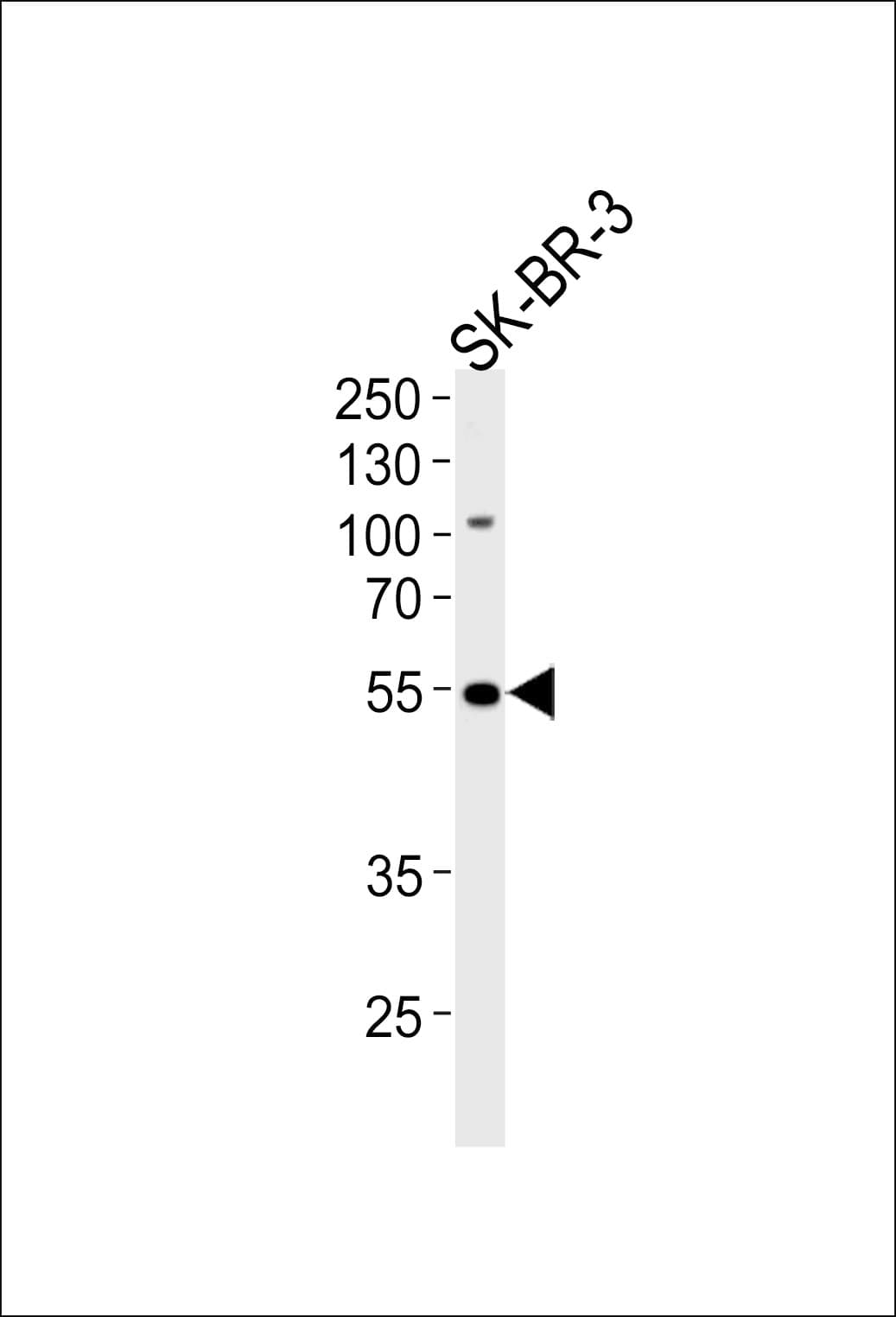 SMARCE1 / BAF57 Antibody (aa307-335)