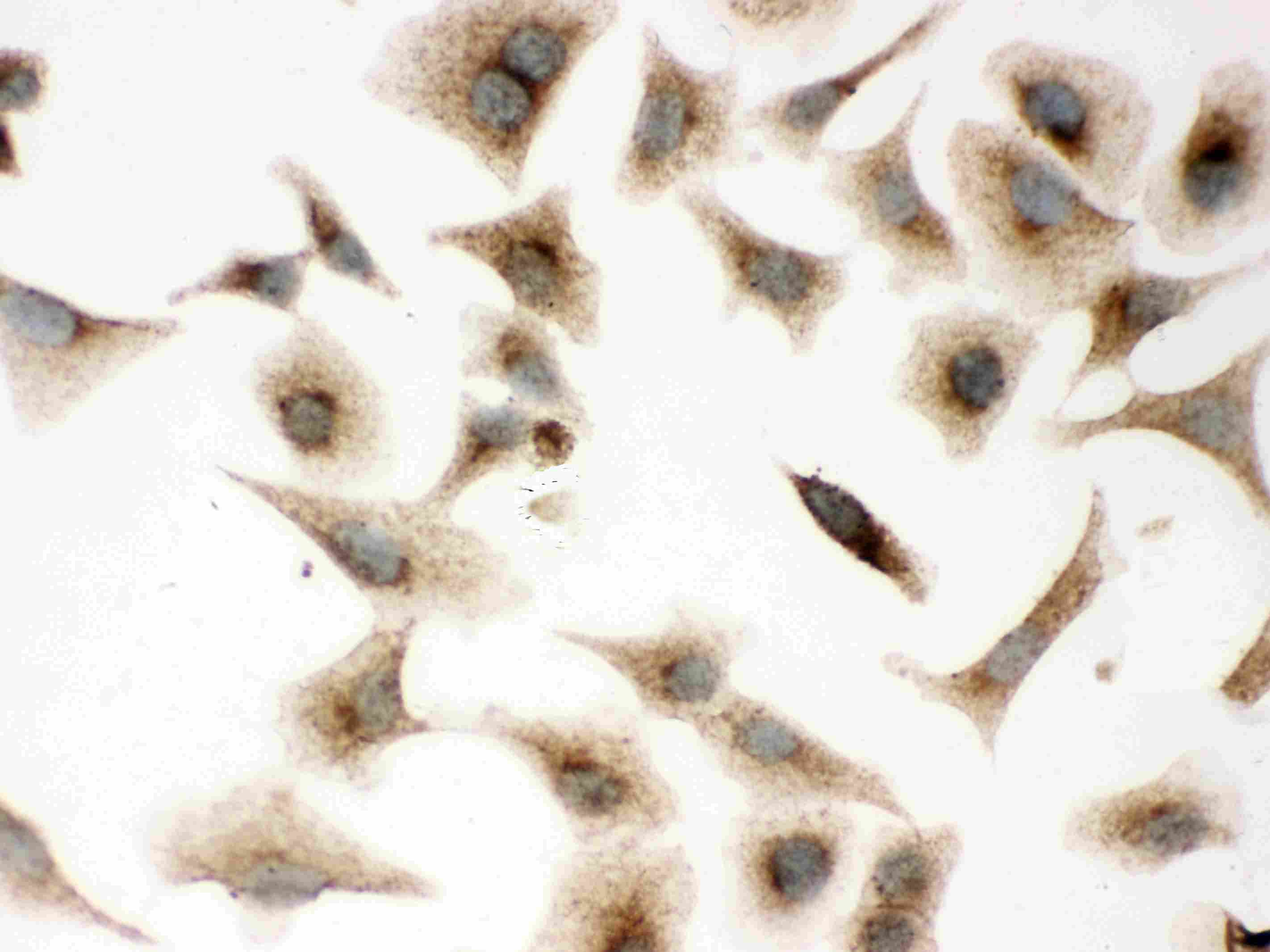 Polyclonal Rabbit anti-Human CAV1 / Caveolin 1 Antibody (aa4-178, IHC, WB)