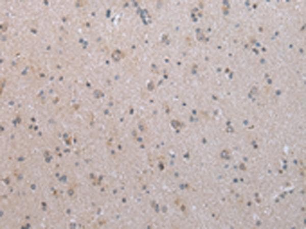 Polyclonal Rabbit anti-Human COX17 Antibody (IHC)