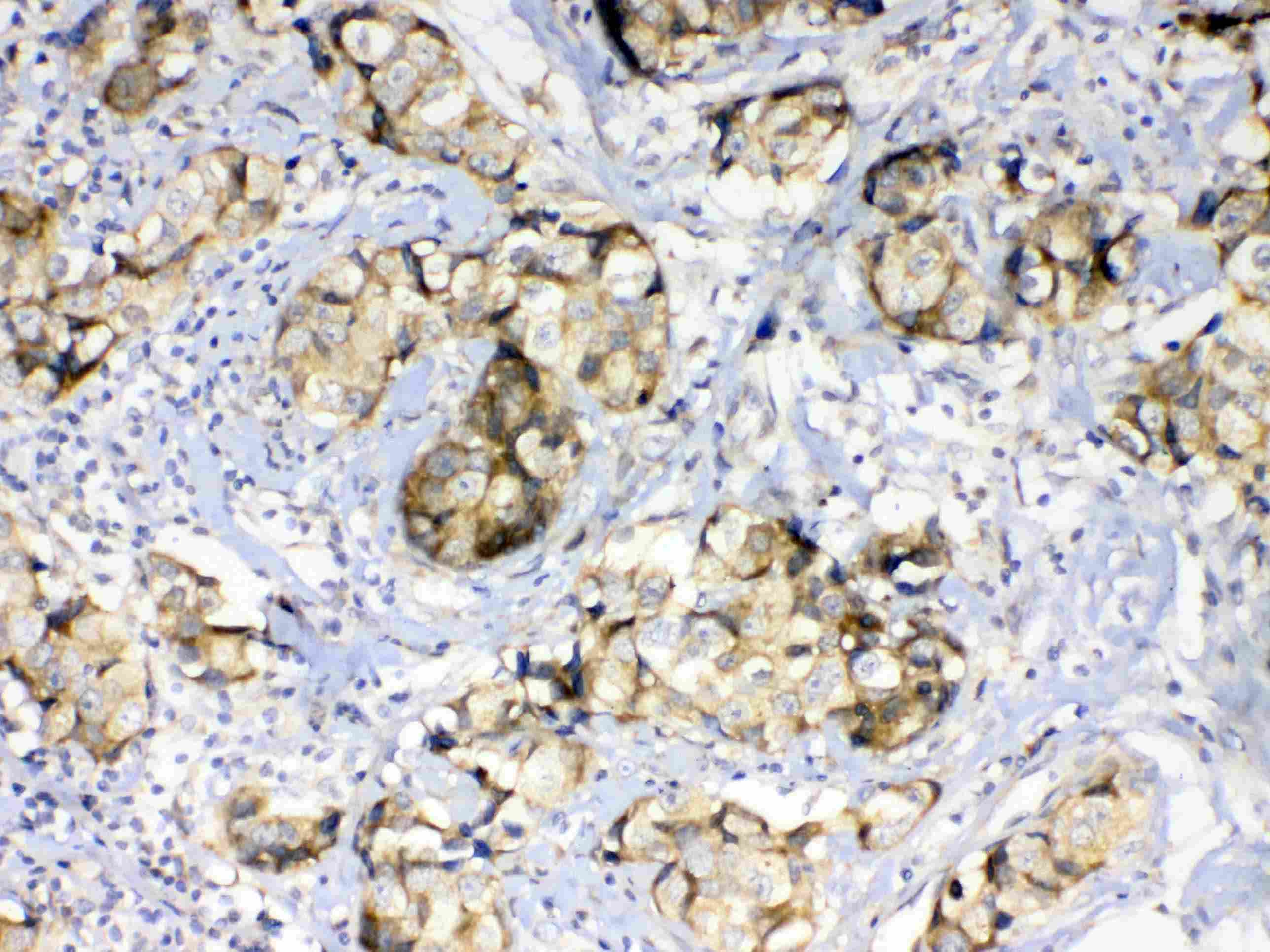 GALE / UDP-Glucose 4-Epimerase Antibody