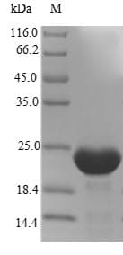 Human IFNA14 / Interferon Alpha 14 Protein (Recombinant GST, N-terminus)