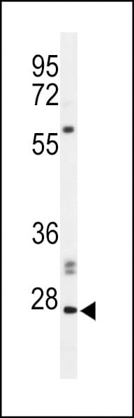 Polyclonal Rabbit anti-Human APOBEC3A Antibody (aa1-30, IHC, WB)