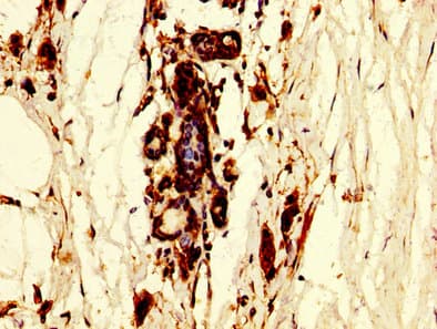 POLR3B Antibody