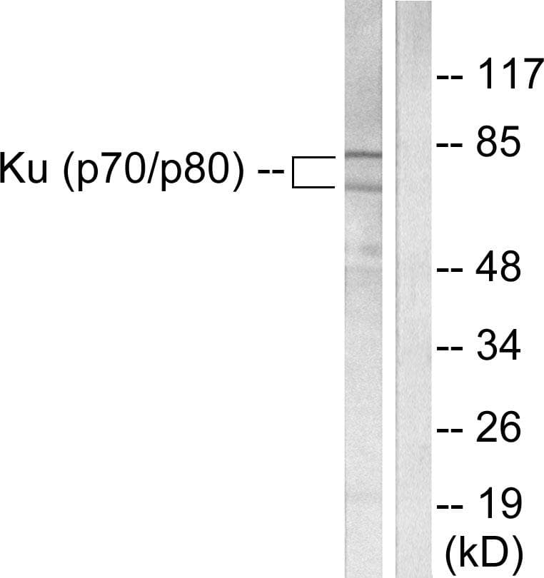 Ku70+Ku80 / XRCC6+XRCC5 Antibody