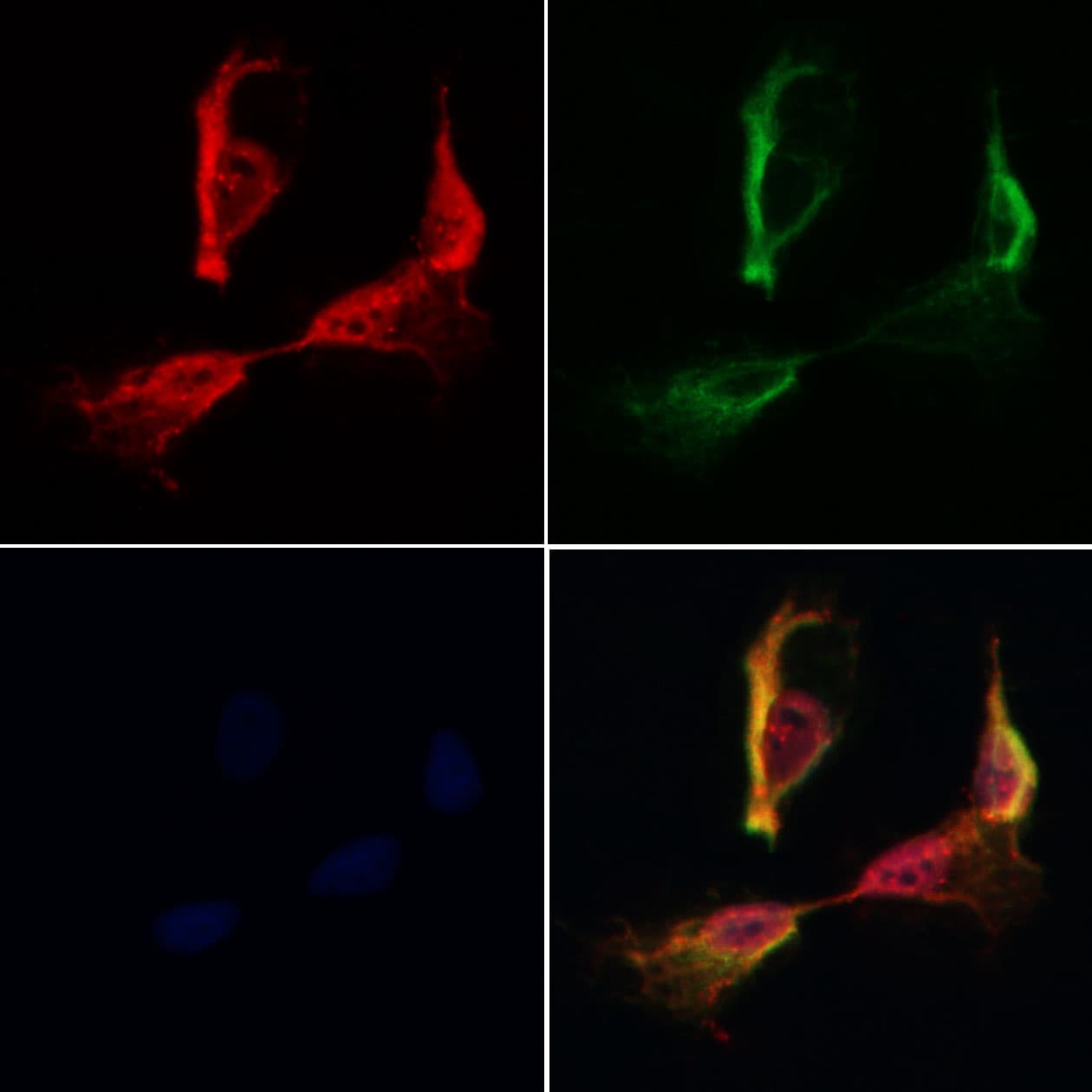 Polyclonal Rabbit anti-Human SSFA2 Antibody (IF, WB)