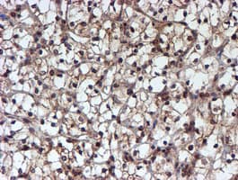 HARS2 Antibody (clone OTI5H2)