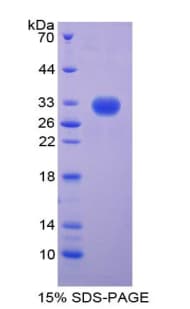 Human CENPH / CENP-H Protein (Recombinant His-T7)