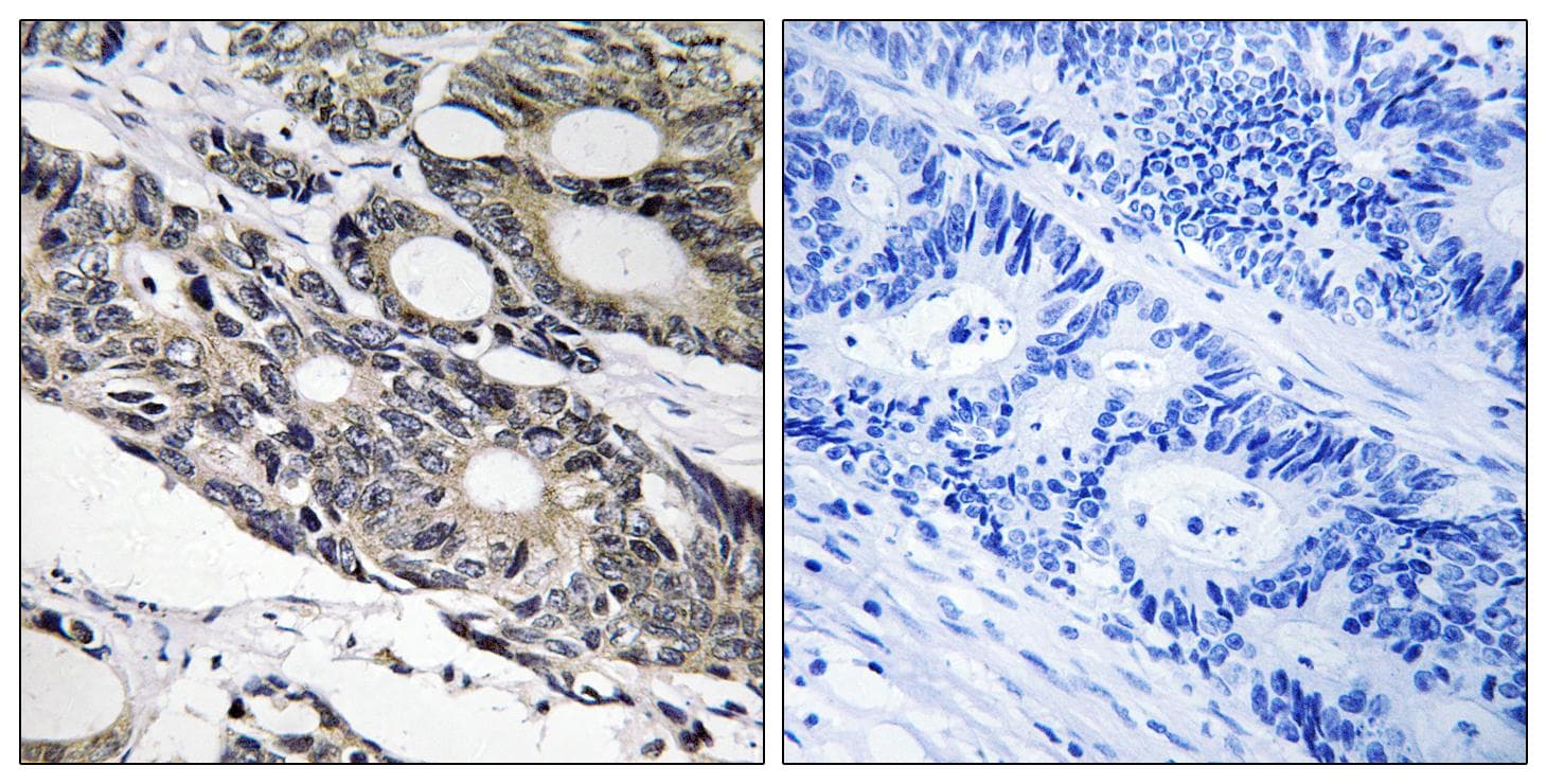 BCL10 / BCL-10 Antibody