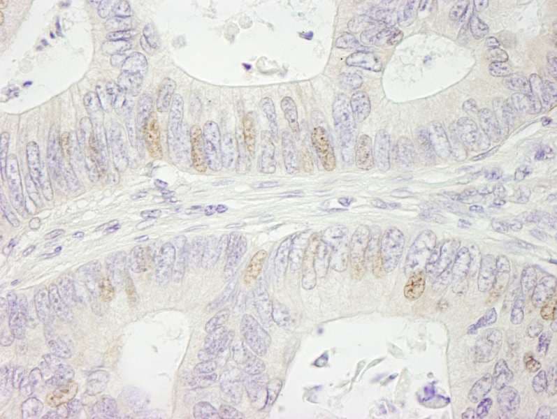SMARCA1 / SWI Antibody (aa1004-1054)