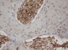 HBS1L Antibody (aa1-260, clone OTI1C1)
