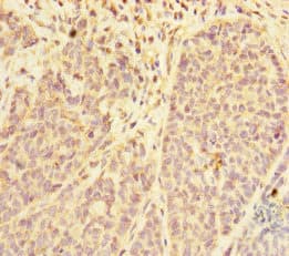 PDE6A / PDE6 Alpha Antibody