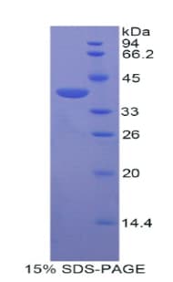 Mouse ADAP2 / CENTA2 Protein (Recombinant His)