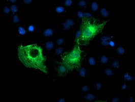 Monoclonal Mouse anti-Human PFKP Antibody (clone OTI3A12, IHC, IF, WB)