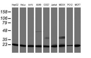 PSMB9 Antibody (clone OTI3F3)
