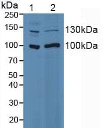 ITGA2 / CD49b Antibody (aa74-277)
