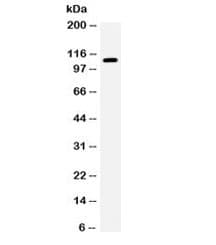 Polyclonal Rabbit anti-Human EPHB1 / EPH Receptor B1 Antibody (IHC, WB)