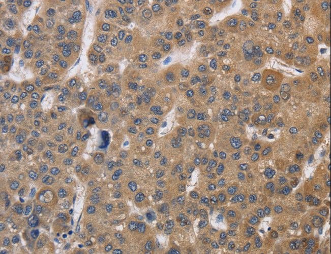 SDCCAG3 Antibody